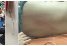 Health orgs to halt services after brutal attack on TRIHMS drs