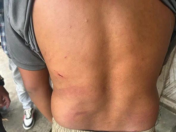 Porters assaulted by Army personnel