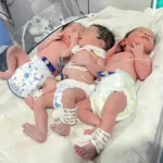 Woman delivers triplets in Itanagar hospital